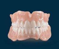 Full upper and lower denture set displayed at European Denture Center